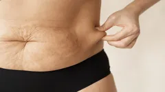 Život po päťdesiatke nezmizne sám od seba – ako aktivovať skrytý režim spaľovania tukov