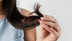 Dietológovia: 4 stravovacie návyky, ktoré nenávratne poškodzujú vlasy